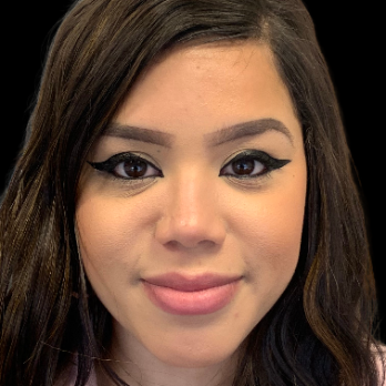 before-and-after-nostril-reduction