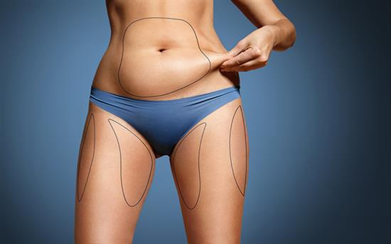 types of liposuction