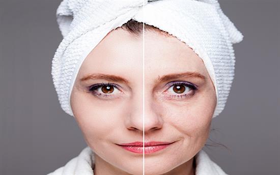 facial rejuvenation surgery